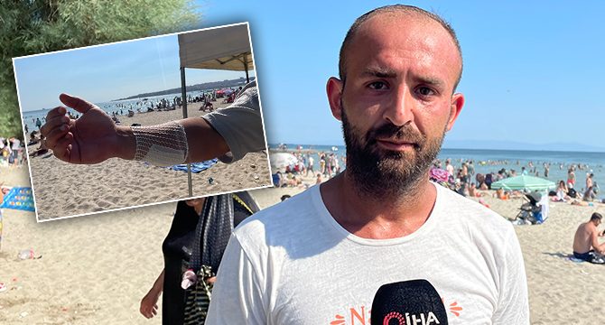 Vakaya müdahale eden cankurtarana döner bıçağıyla saldırdı