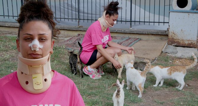Pitbull beslediği kedilere saldırdı: Tartıştığı sahibi burnunu kırdı