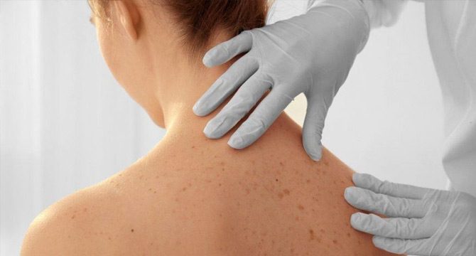 Prof. Dr. Özkan uyardı: Vakalar artıyor, üç yaşında hastamız bile var