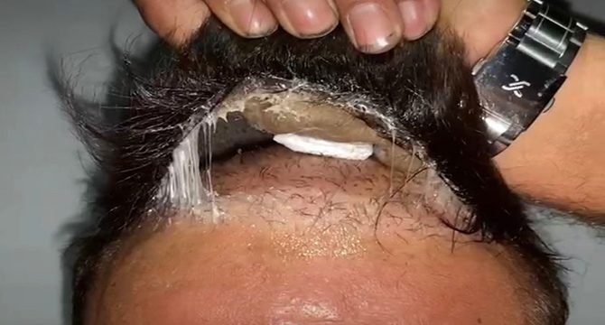 Şüphelinin peruğundan uyuşturucu çıktı